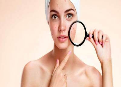 Tratamiento Facial Acne