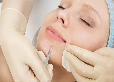 Le realizan a una mujer una limpieza facial profunda